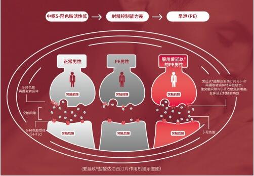 首个国产早泄药爱廷玖发布售价，赋能男性健康市场全新品类