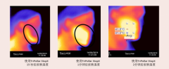 亚洲人皮肤三大特性：初普TriPollar射频美容仪提供针对性抗老解决方案